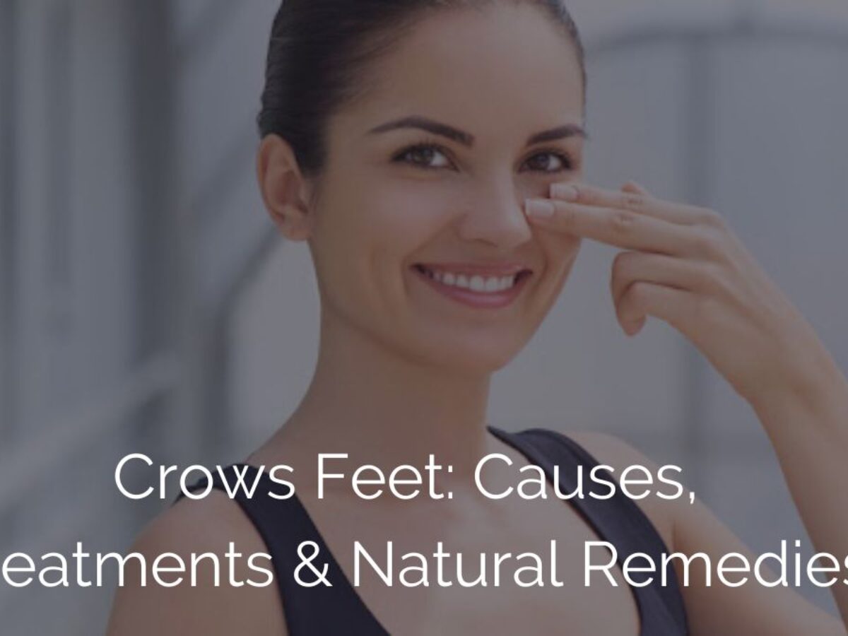 Crows Feet Causes Treatments and Natural Remedies