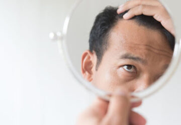 what causes hair fall