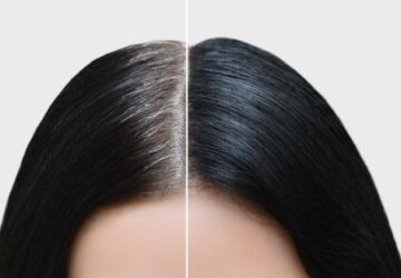 How to stop white hair