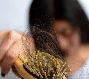 Reasons for Hair Fall