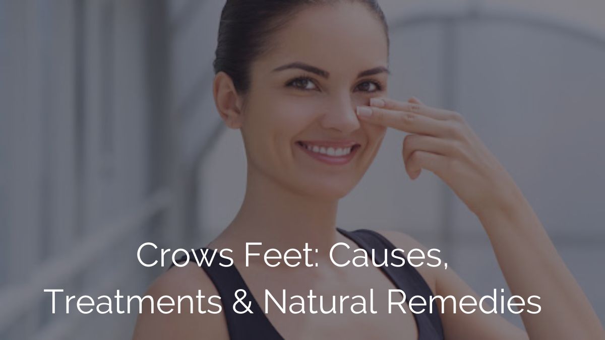 Crows Feet: Causes, Treatments, and Natural Remedies