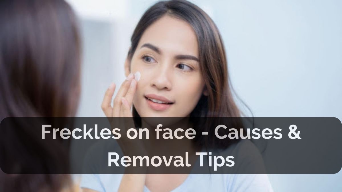 Freckles on Your Face? Here’s What You Should Know