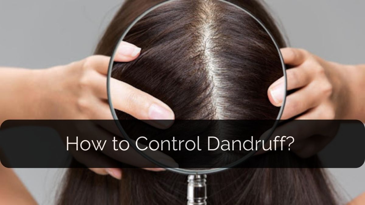 How to Control Dandruff ?