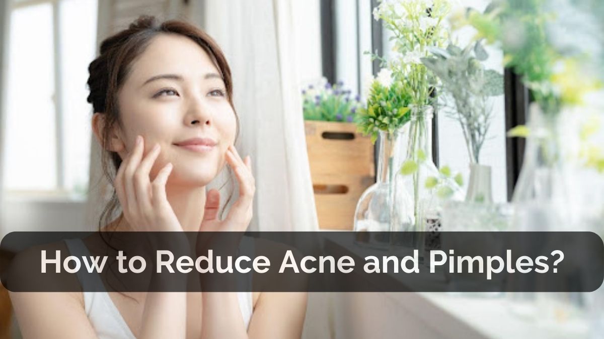 What is Acne on Face?