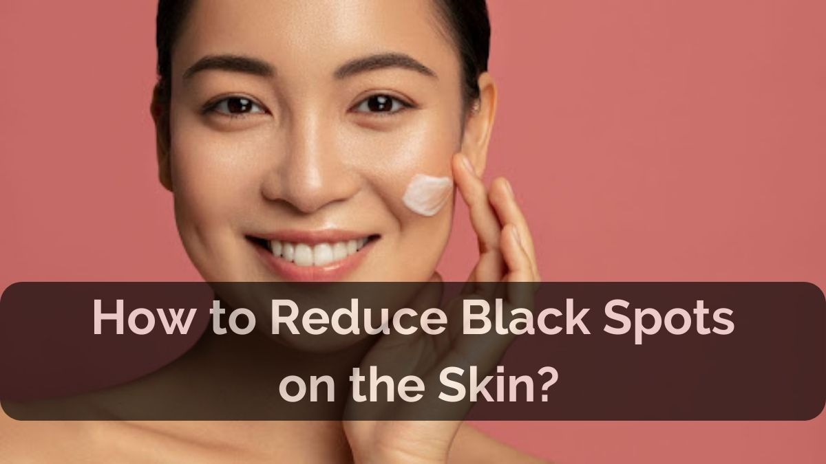 Black Spots on Face, Skin & Body: Causes & Removal Tips