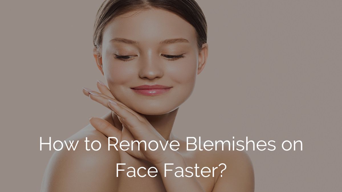 Blemishes on Face - Meaning, Types, Benefits & Treatment