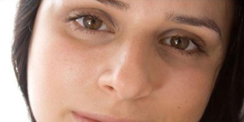 Say goodbye to dark circles & puffy eyes with these 5 easy ways!
