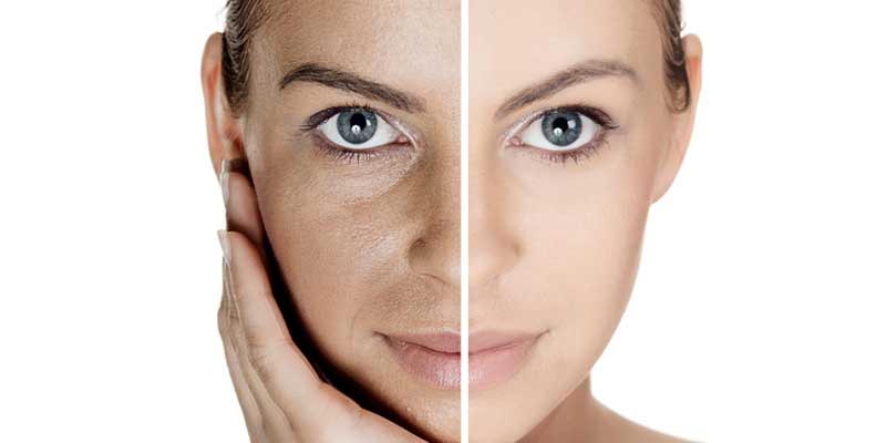 Combat dark skin during pregnancy, acne and other skin problems with these 6 easy steps.