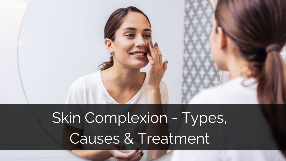 Skin Complexion Types, Causes & Treatment