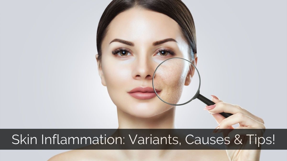 Skin inflammation- Causes & Tips to manage Inflamed Skin