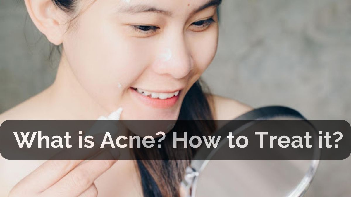 What is Acne? | Causes | Mamaearth Blog