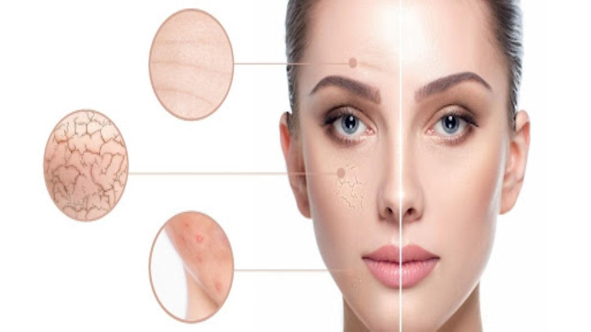 How to Remove Dark Spots on Face?