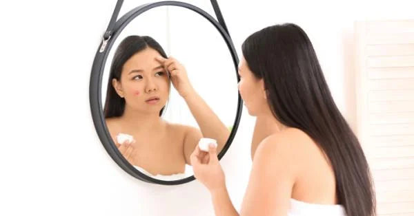 Anti Acne Gel Benefits for Skin Care