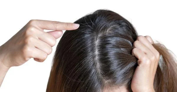 Graying of Hair - Causes & Treatment