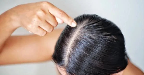 Best Oily Scalp Shampoo for Hair Care Treatment