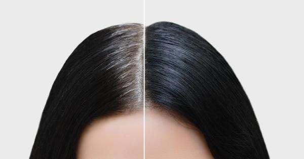 How to Stop White Hair?