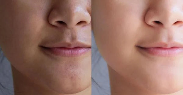 Radiant Skin Tips to Achieve Naturally Youthful Skin