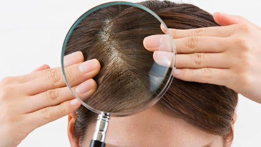 Thin Hair: Definition, Causes, Myths & Treatments at Home