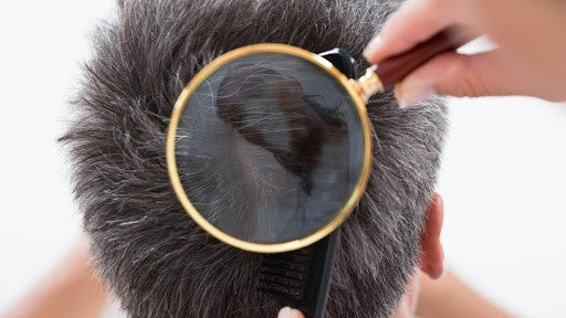 What Causes Premature Greying of Hair? | Mamaearth