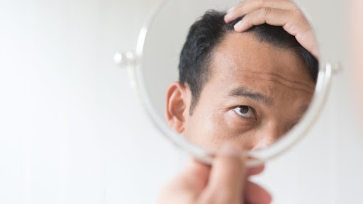 What Causes Hair Fall? | Mamaearth