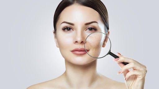 What Causes Dark Spots on Face? | Mamaearth