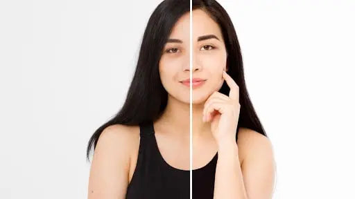 How to Remove Wrinkles under Eyes? | Mamaearth