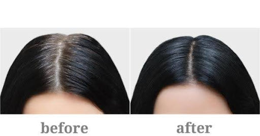 How To Black Your Hair Naturally | Effective Tips | Mamaearth