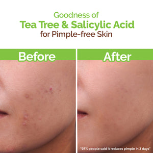 Tea Tree Pimple Control Face Wash with Tea Tree & Salicylic for Oily & Acne-Prone Skin - 250ml