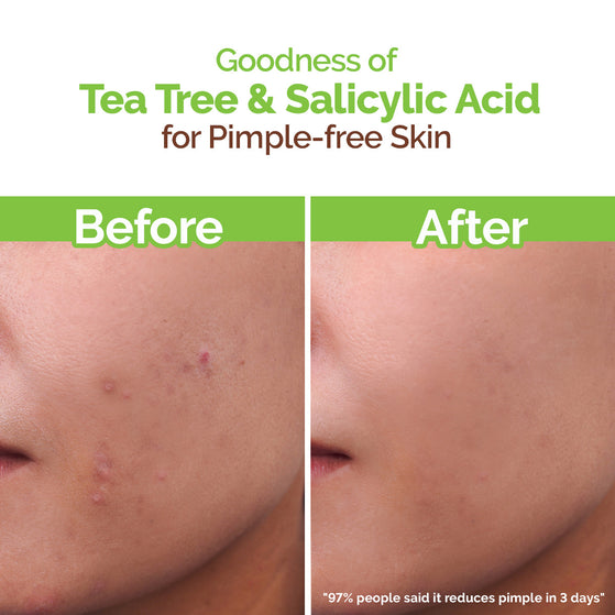 Tea Tree Pimple Control Face Wash with Tea Tree & Salicylic for Oily & Acne-Prone Skin - 250ml