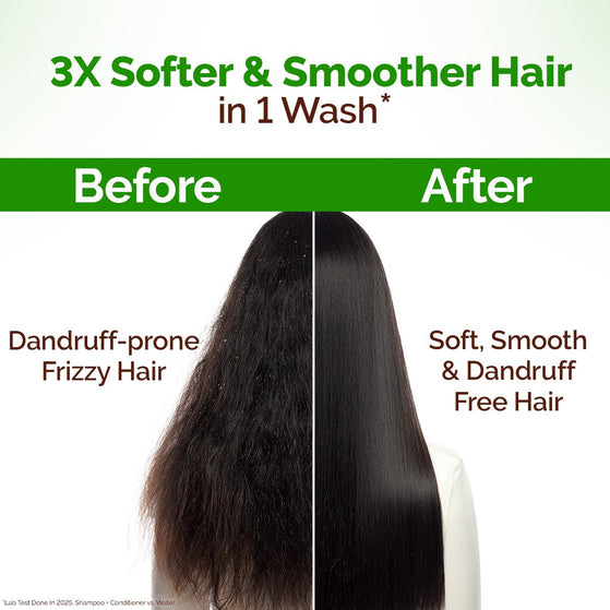 Lemon Anti-Dandruff Conditioner with Lemon & Aloe Vera for Itchy & Flaky Scalp - 250 ml