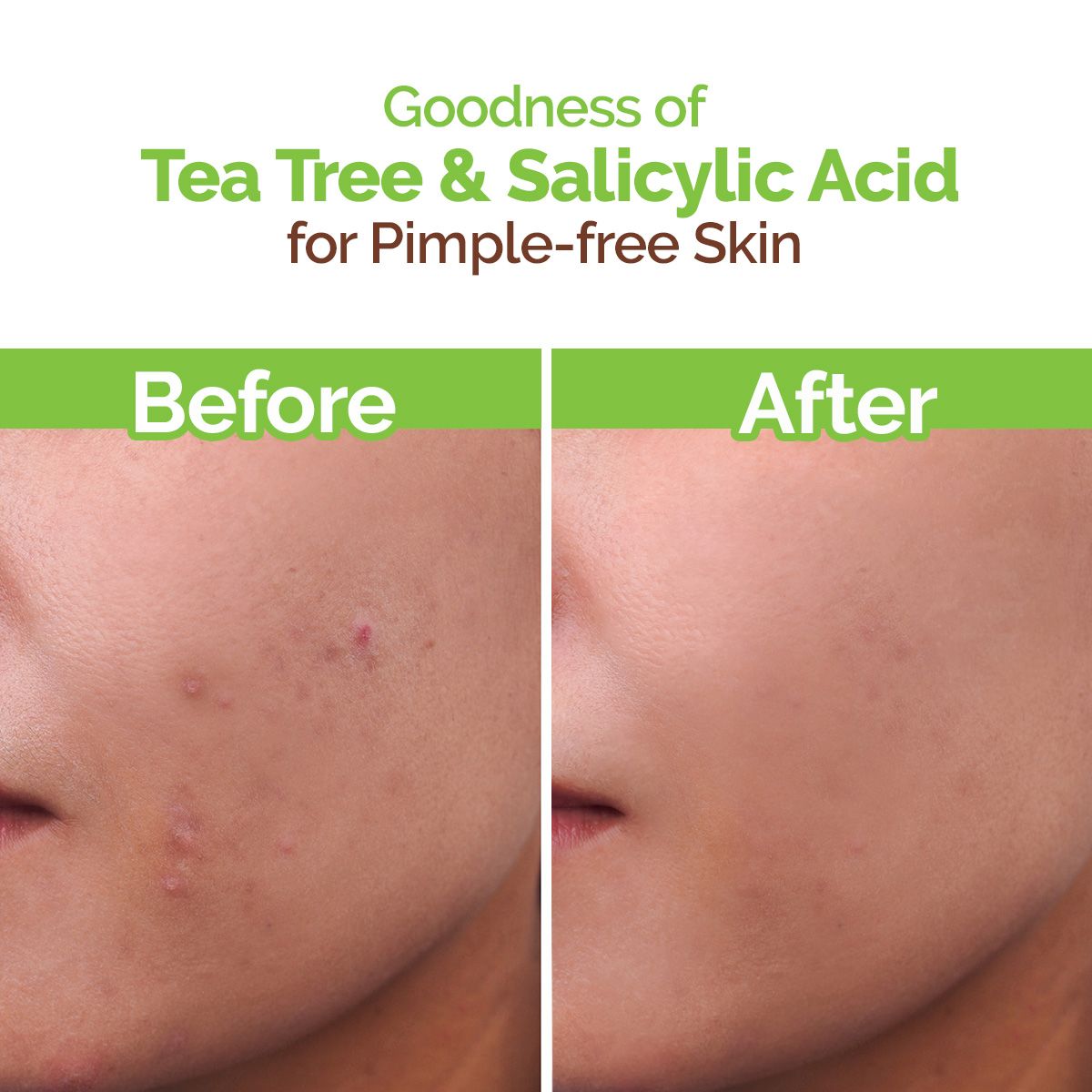 Tea Tree Pimple Control Face Wash with Tea Tree & Salicylic for Oily & Acne-Prone Skin - 250ml