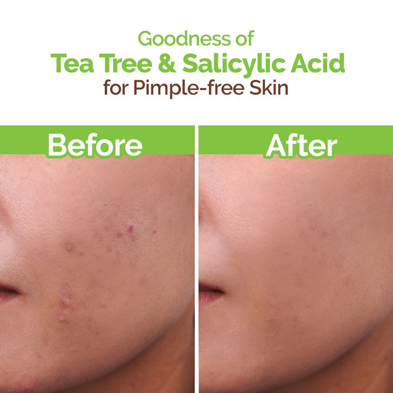 Tea Tree Pimple Control Face Wash with Tea Tree & Salicylic for Oily & Acne-Prone Skin - 250ml