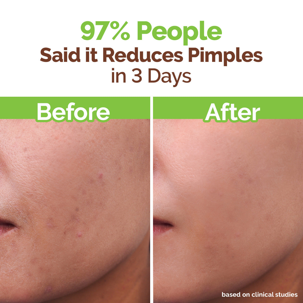 Tea Tree Pimple Control Face Wash with Tea Tree & Salicylic for Oily & Acne-Prone Skin - 250ml