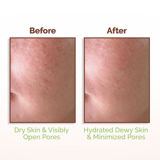 Rice Water Dewy Face Toner with 96% Pure Rice Water Extract & 4% Niacinamide for Glass Skin - 150 ml