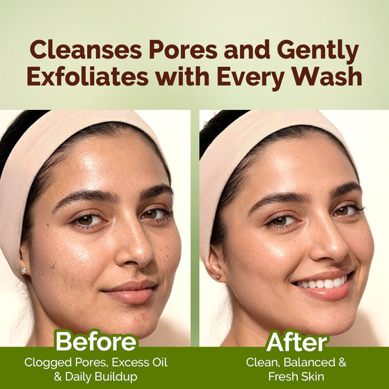Mung Bean Pore Cleansing Face Wash with Mung Bean, AHA & BHA for Normal to Oily Skin - 100 ml