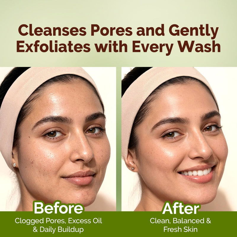 Mung Bean Pore Cleansing Face Wash with Mung Bean, AHA & BHA for Normal to Oily Skin - 100 ml