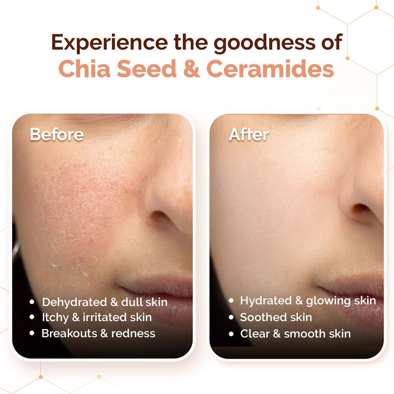 Chia Calming Face Cleanser with Chia Seed & Ceramides for Dry & Sensitive Skin - 180 ml