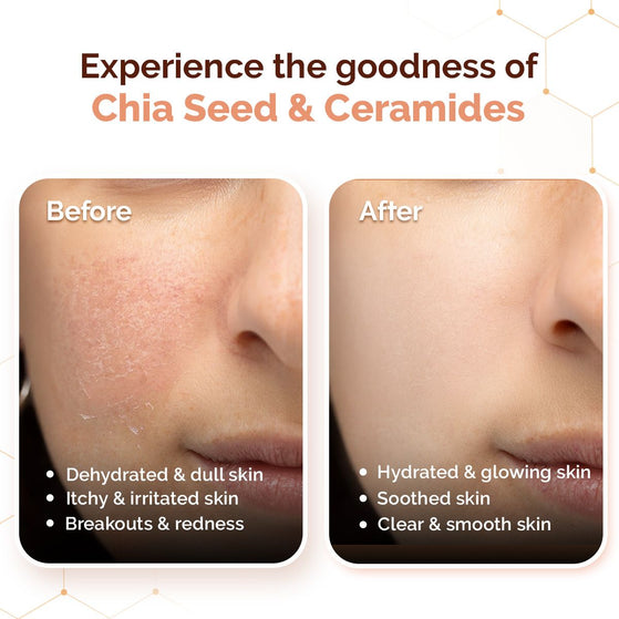 Chia Calming Moisturizer with Chia Seed & Ceramides for Healthy Skin Barrier - 80g