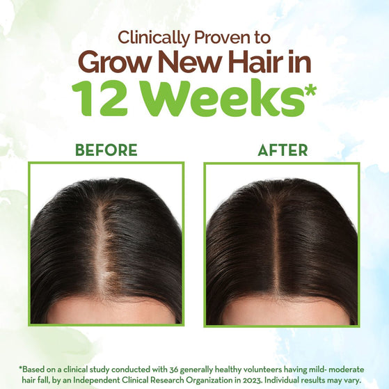 Rosemary Hair Growth Oil with Rosemary & Methi Dana for Promoting Hair Growth - 150 ml (Pack of 2)