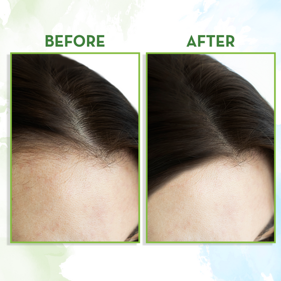 Rosemary Hair Growth Oil with Rosemary & Methi Dana for Promoting Hair Growth - 100 ml