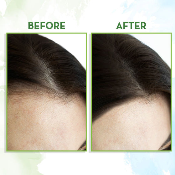rosemary essential oil for hair growth