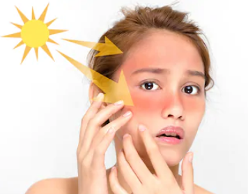 Repairs Sun Damage